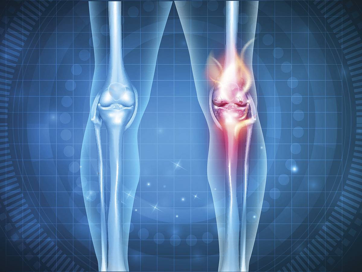 Knee pain abstract design